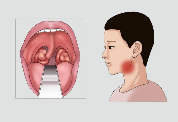 怎么练就纤细微蛮腰 这些办法让你具有小细腰